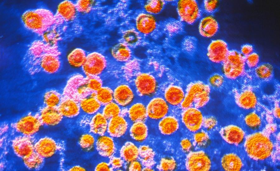 خبير يحذر من عودة كارثية لفيروس الحصبة بعد الخلاص من كابوس كورونا