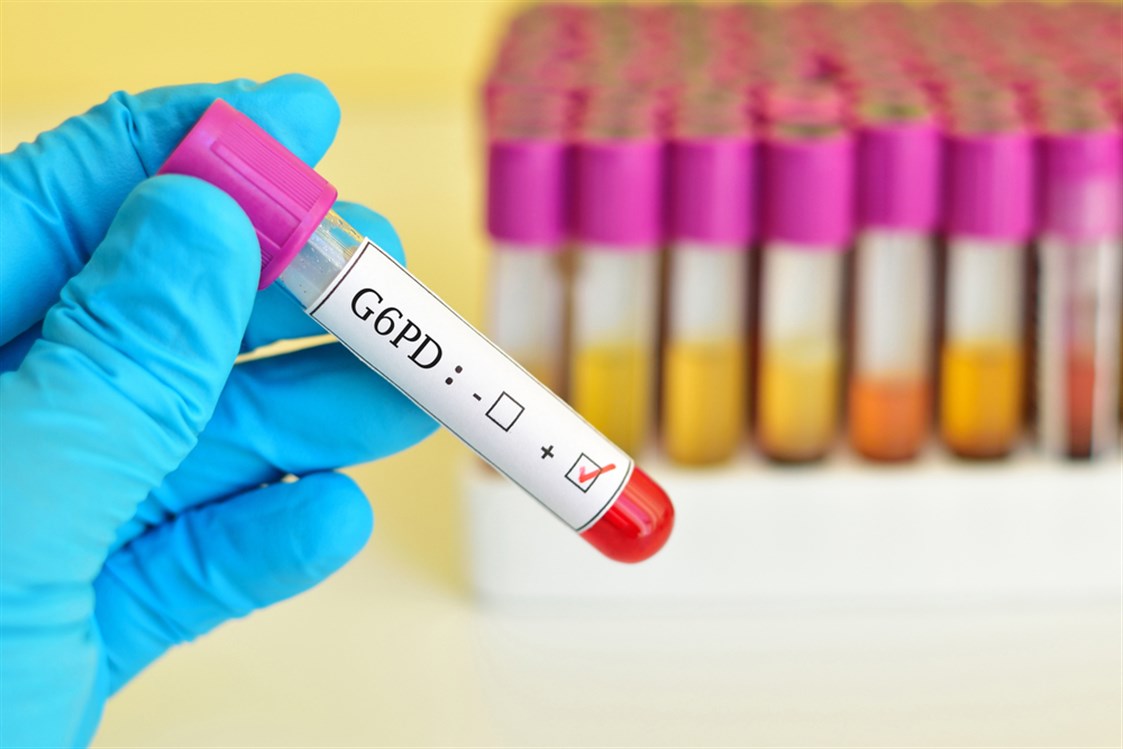 ما هو مرض انيميا الفول؟ وهل هو خطير؟