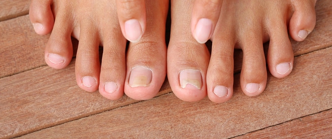 ألوان الأظافر: إلى ماذا تشير؟