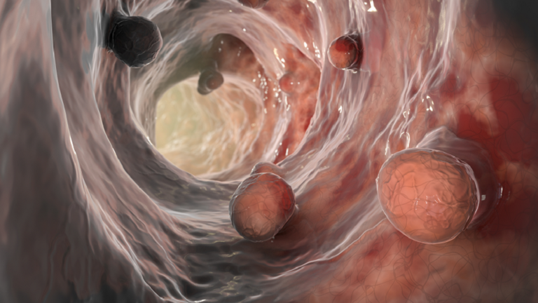 تغييرات صامتة  قد تدل على السرطان ينبغي فحصها في أقرب وقت ممكن!