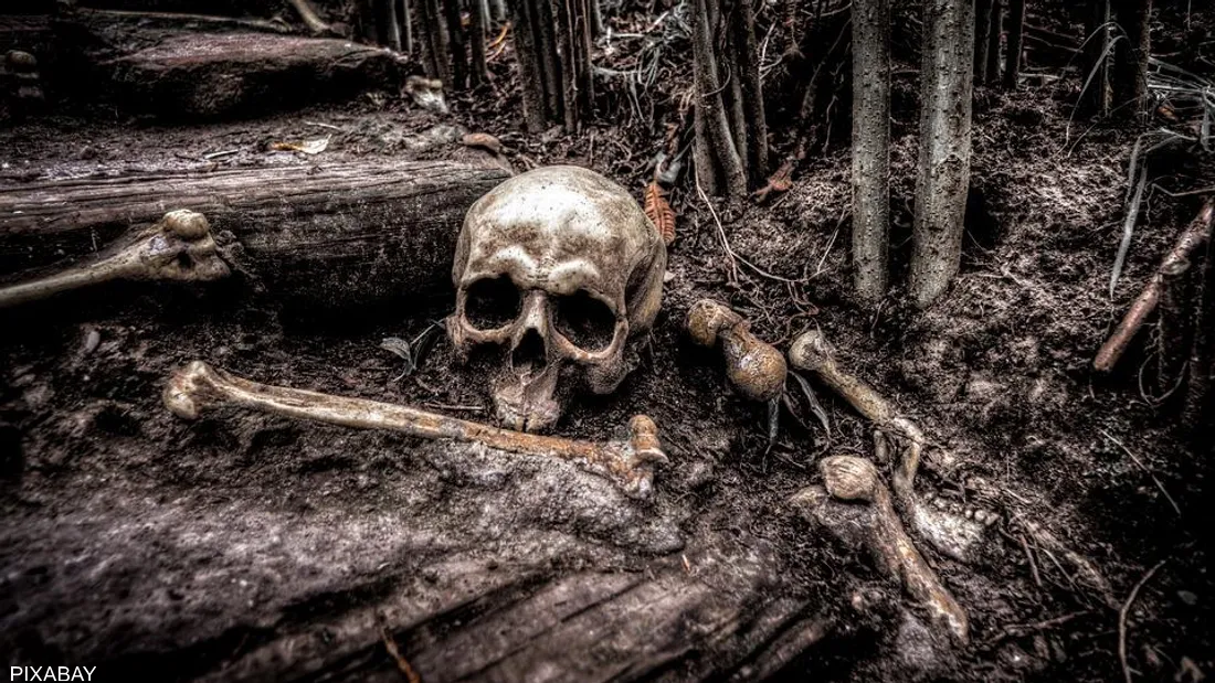 العثور على هيكل عظمي عمره 1000 عام بمتلازمة وراثية نادرة