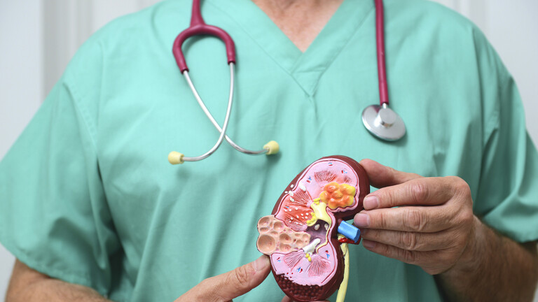 أدوية متاحة تبعث أملا جديدا في علاج سرطان الكلى