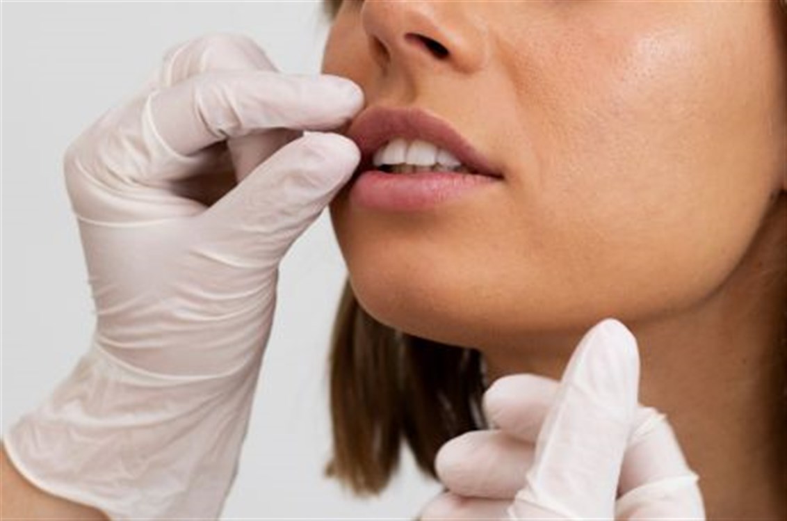 ما الذي يكشفه لون شفاهكم عن صحّتكم؟