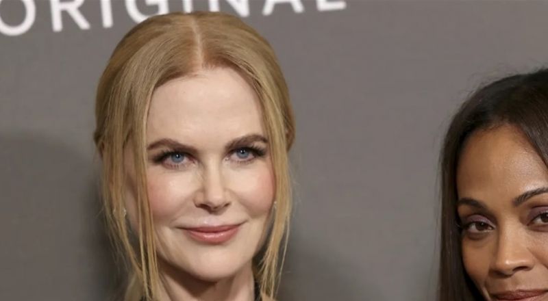 بعدما فقدت الكثير من وزنها.. عائلة نيكول كيدمان خائفة على صحتها