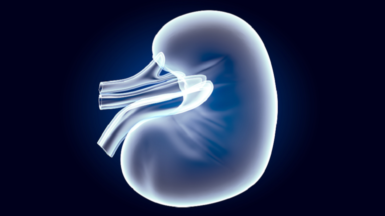 طفرة ثورية في علاج رفض زرع الكلى