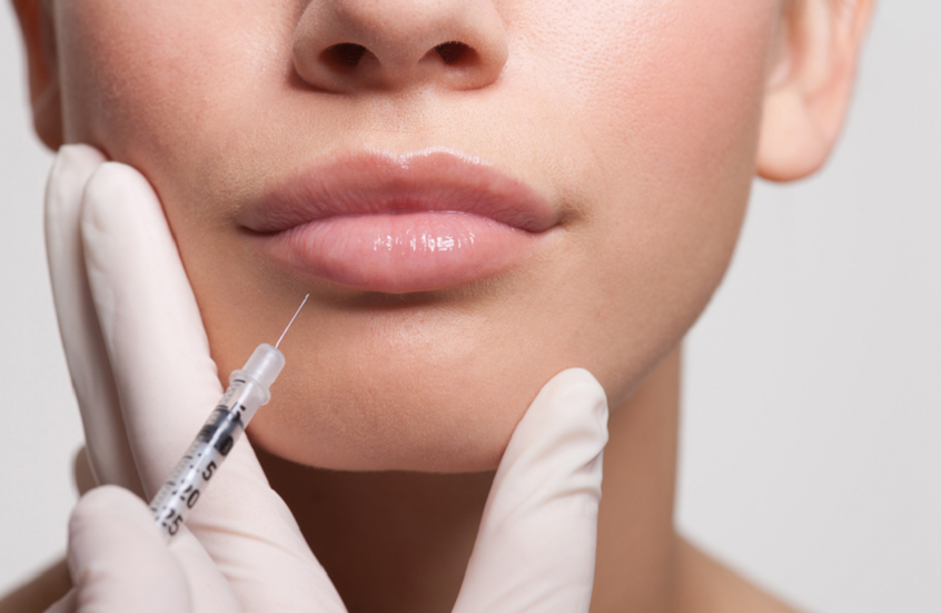 الشفاه المثالية في عيون الرجال والنساء.. هل تتفق مع النتائج؟