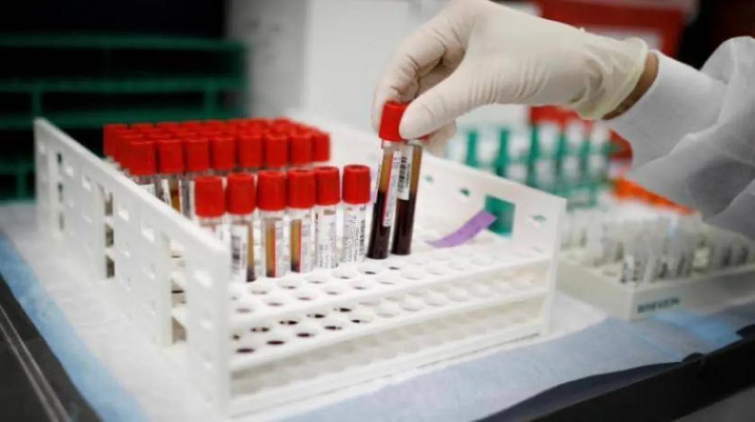 علماء يكتشفون فصيلة دم جديدة