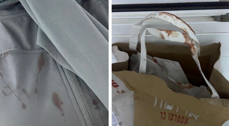 طالبة في الجامعة العبرية تتعرض لاعتداء دموي على يد مستوطنين في المحطة المركزية بالقدس